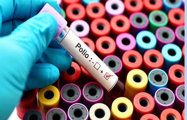 New polio case emerges in Pakistan in 2025