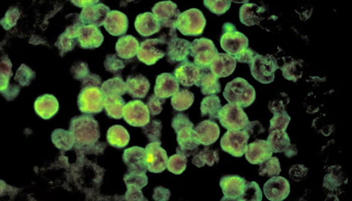 Karachi reports fourth Naegleria death of 2025