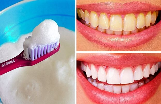 Natural Ways to Whiten Your Teeth at Home