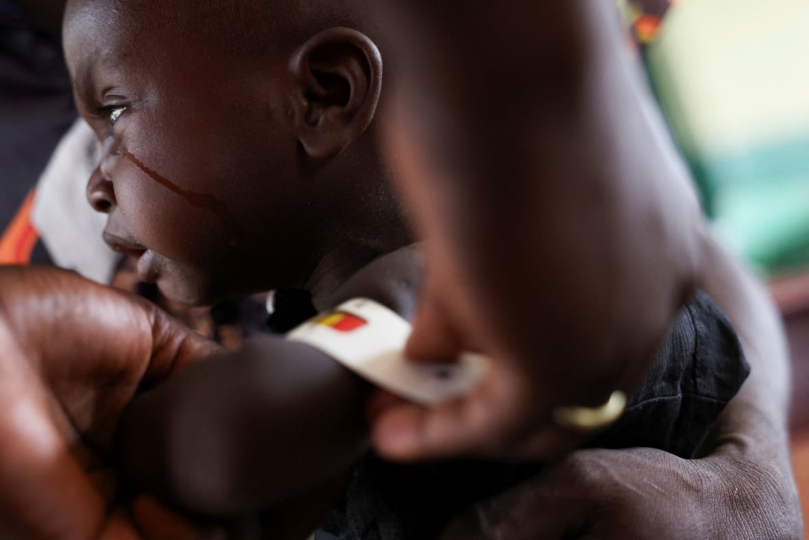 Trump stopped the global fight against HIV/AIDS in its tracks. Canada can help fix it